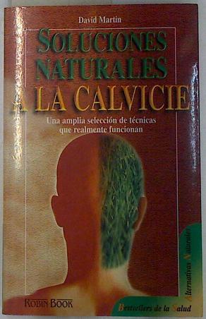 Soluciones naturales a la calvicie. Una amplia selección de técnicas que realmente funcionan | 132308 | Martin, David