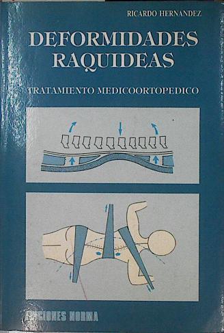 Tratamiento médico-ortopédico deformaciones raquídeas | 144858 | Hernández Gómez, Ricardo